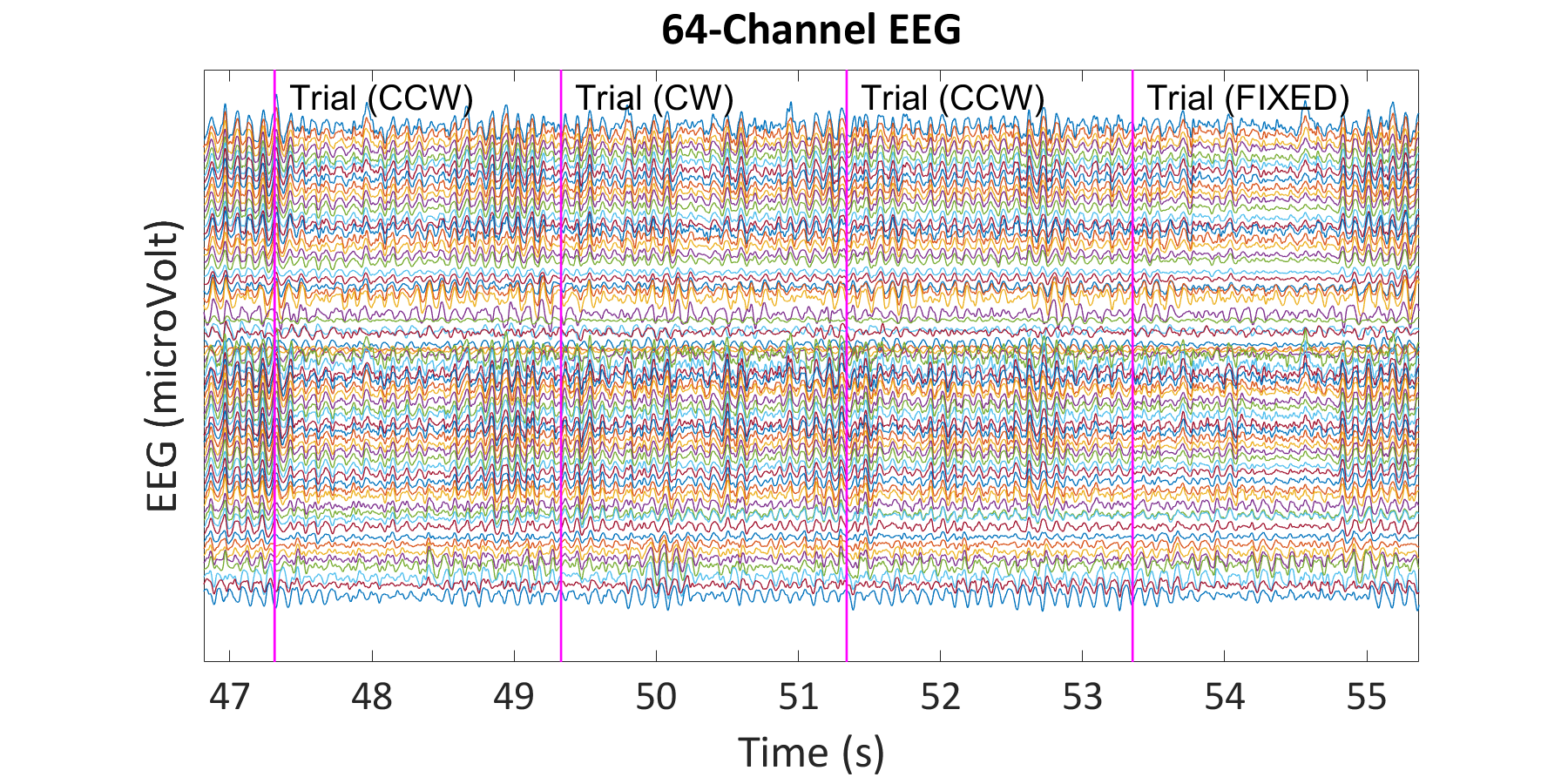 64-Channel EEG